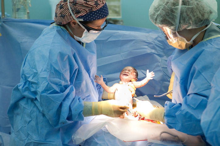 Proses pengeluaran bayi dari perut ibu pada proses persalinan caesar (Foto oleh Brendan Hoffman/Getty Images)