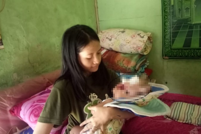Diceraikan karena suami malu dengan kondisi anaknya, wanita ini harus berjuang membesarkan anaknya yang sakit sendirian