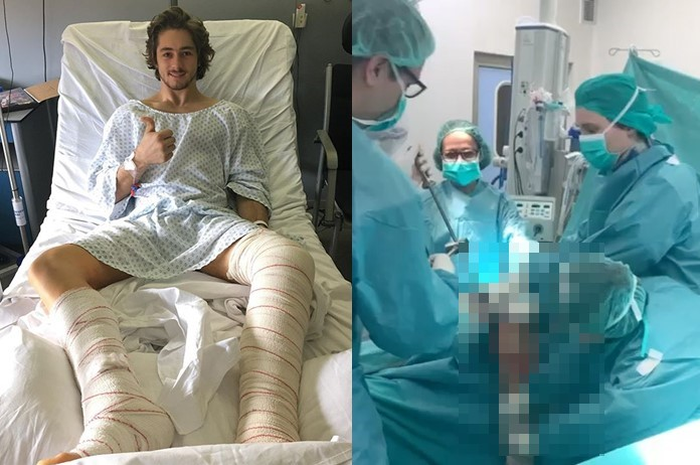 Remy Gardner harus dioperasi untuk melepas pen dan baut