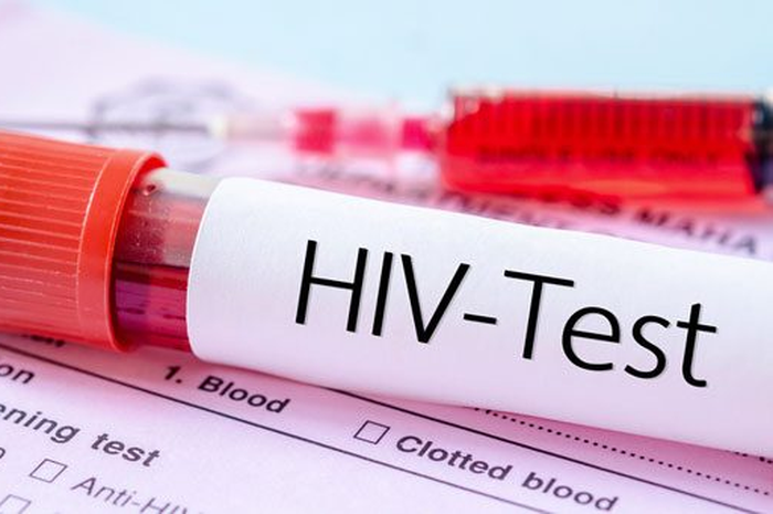 Kasus HIV/AIDS di kota Bandung.
