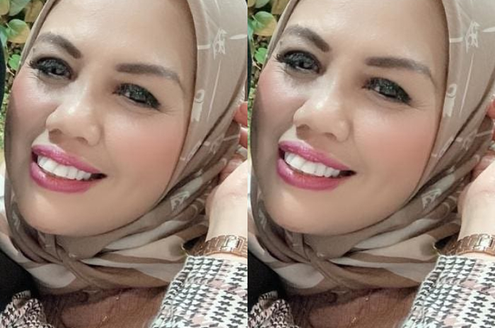Potret penmapilan baru Elly Sugigi dengan bentuk gigi yang lebih rapi hingga bikin netizen pangling