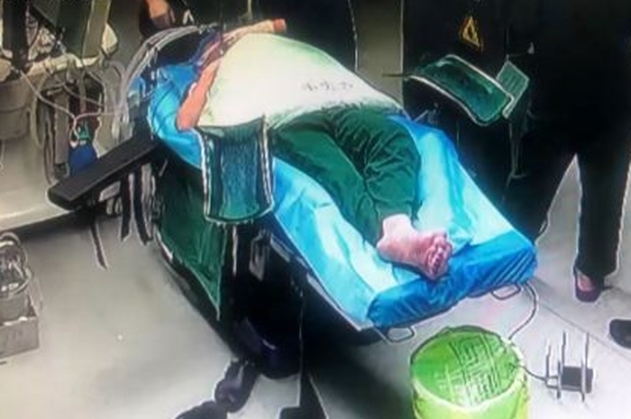 Seorang dokter asal Tiongkok bernama Liu nyaris alami hal tragis karena dedikasinya untuk menyelamatkan nyawa pasiennya.