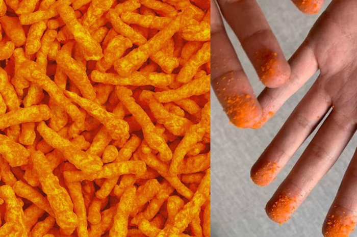 Ilustrasi remah Cheetos di jari