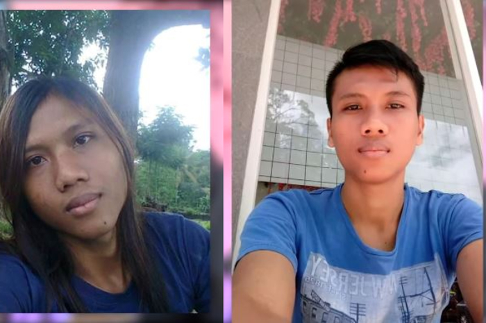 Kevin, pemuda asal Tegal yang terlahir dengan 2 alat kelamin