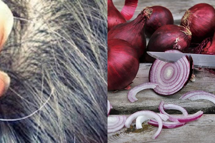 kolase uban dan bawang merah ( source: intisari dan nakita)