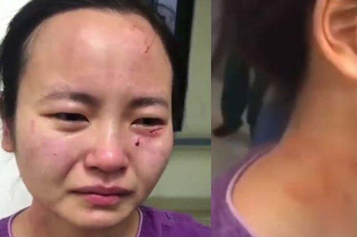Nasib Menderita Seorang Perawat Tak Bisa Menahan Tangis saat Alami Kekerasan dari Pasien Virus Corona, Sekujur Tubuhnya Penuh Luka, Ternyata Pelaku Lakukan Hal Gila Ini