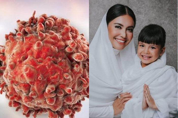 Sering Dikaitkan dengan Penyakit Berbahaya para Artis, Ini Fakta yang Jarang Diketahui Mengenai Dry Cleaning