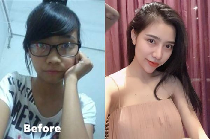 Wanita ini Dibenci Ibunya Sendiri Usai Permak Penampilannya dengan Operasi Plastik Hingga Berubah Cantik, Perubahan Sebelum dan Sesudahnya Bikin Melongo
