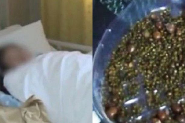 Wanita ini tidak sarapan dan kurang minum air putih. Ini yang ditemukan dokter pada tubuhnya, membuat mereka shock!