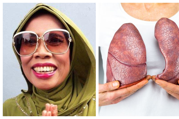 (ilustrasi) Meninggal Dunia, Komedian Omas Punya Riwayat Penyakit Komplikasi, 6  Cara Ini Dapat Menjaga Paru-paru Anda Tetap Sehat.