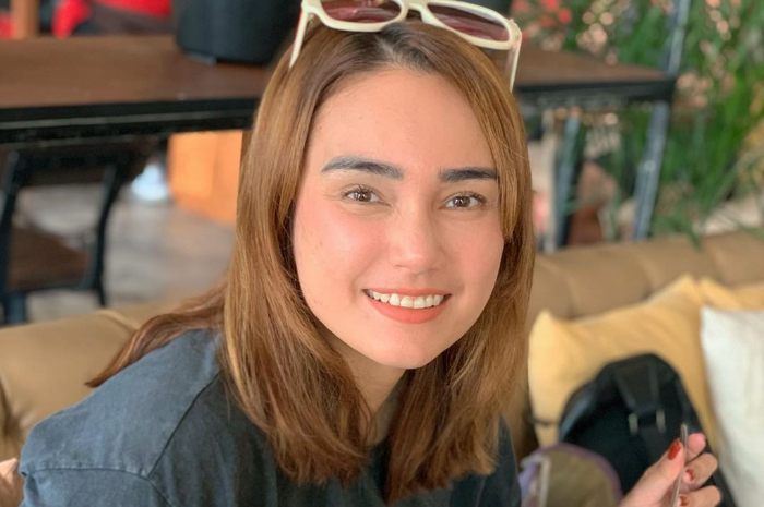 Feby Febiola kejutkan penggemar dengan penampilan terbarunya usai jalani kemoterapi
