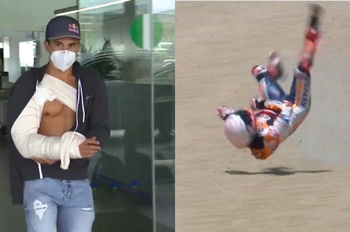 Babak belur di MotoGP Spanyol 2020, kapan Marc Marquez bisa balapan lagi?