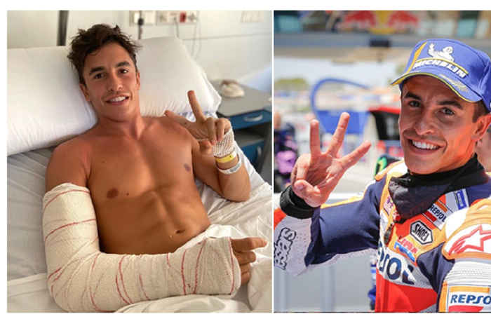 Dokter olahraga Profesor Carlo Tranquilli, menjelaskan risiko terburuk Marc Marquez jika terjatuh lagi di MotoGP Andalusia 2020.
