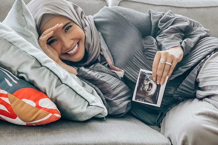 Zaskia Sungkar