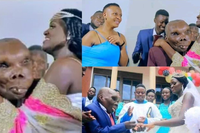 Wajah Godfrey Baguma yang dijuluki pria terjelek di Uganda sempat menjadi berkah, namun kini kembali musibah.