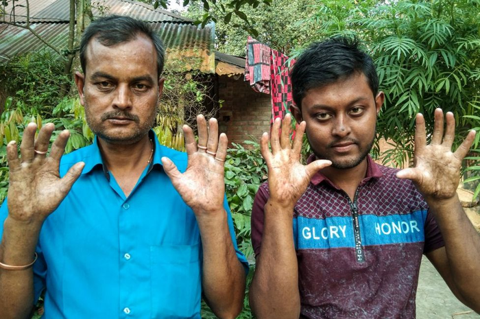 Amal dan Apu Sarker