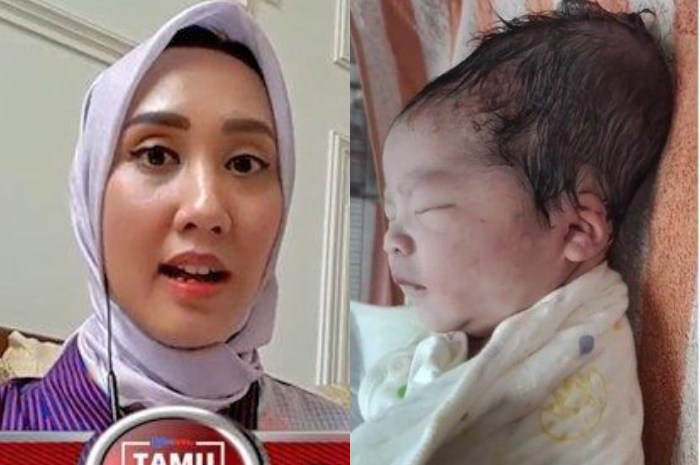 dr. Huthia Andriyana, SpOG memberikan tanggapan soal bayi viral yang lahir dengan kepala lonjong akibat alat vakum