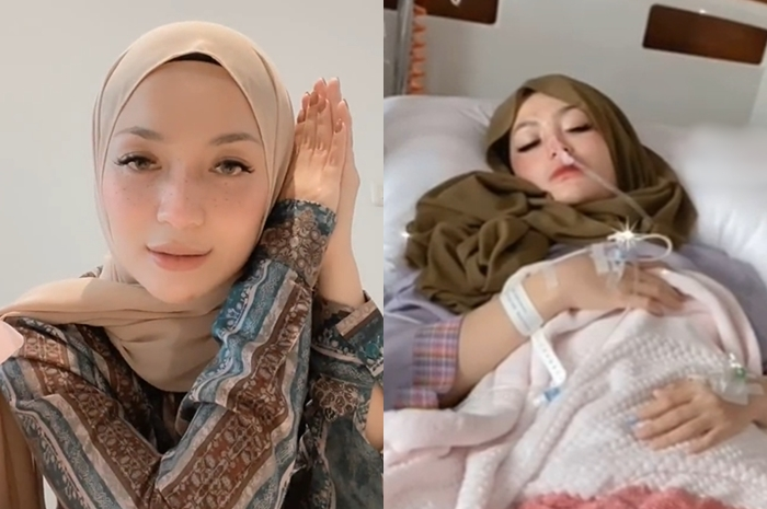 Imel Putri Cahyati sakit endometriosis