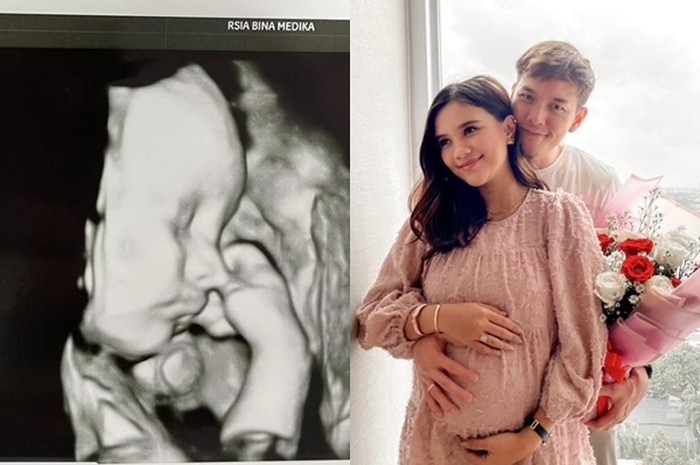 Audi Marissa melahirkan anak pertama pada Rabu (7/4/2021).