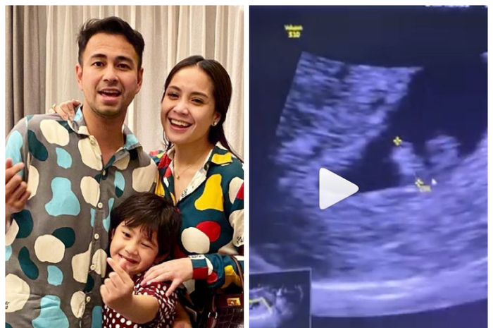 Nagita Slavina hamil anak kedua