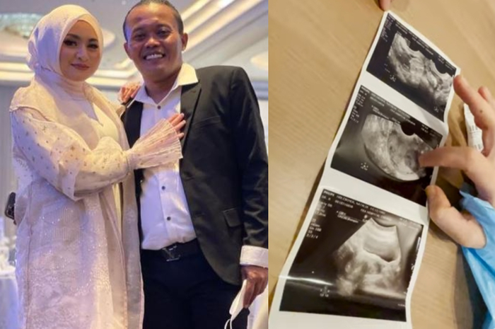 Diisukan Pisah Ranjang Hingga Nyaris Bercerai, Nathalie Hoslcher Tiba-tiba Kejutkan Publik Saat Umumkan Positif Hamil, Netizen Seketika Heboh Minta Sule Lakukan Ini