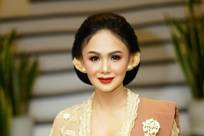 Yuni Shara khawatirkan kondisi Aurel Hermansyah