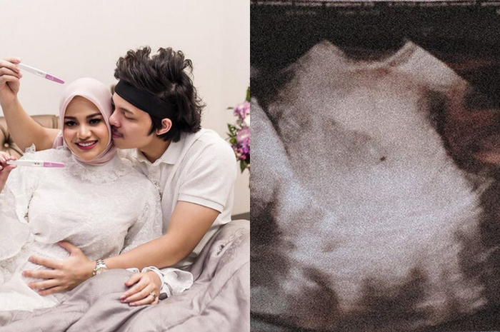Atta Halilintar dan Aurel Hermansyah