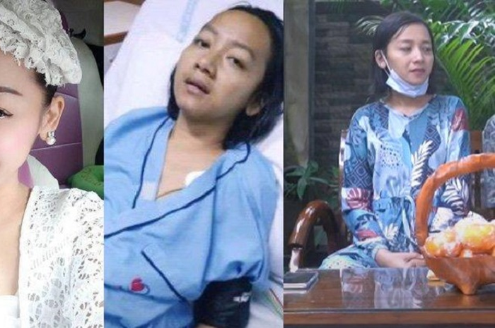 Penyanyi dangdut Elyn Munchen kini tengah berjuang melawan penyakit stroke.