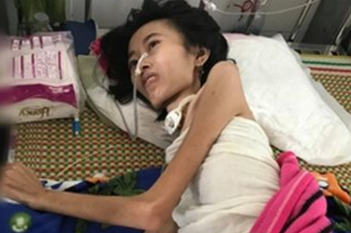 Wanita dengan berat hanya 19 kg ini berhasil lahirkan bayinya dengan berat 1,8 kg.