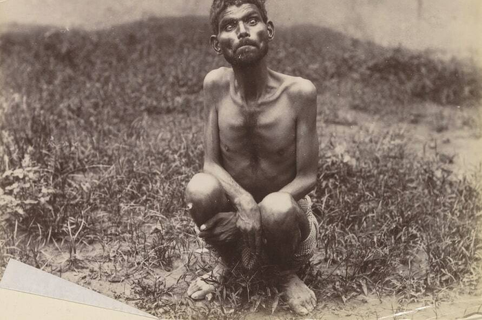 Potret Dina Sanichar, yang dikenal luas sebagai Mowgli di kehidupan nyata, diambil antara tahun 1889 dan 1894.
