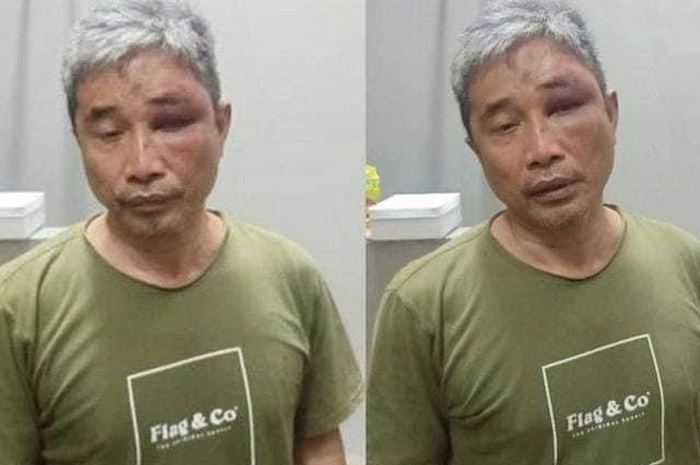 Disebut lumuri Muhammad Kece dengan tinja, Jenderal Napoleon Bonaparte buka suara. Foto tampang bengap sang YouTuber menjadi bukti.