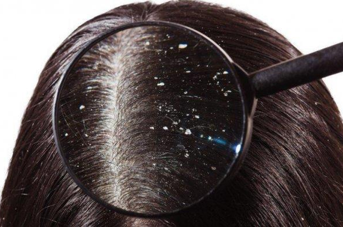 Illustrasi Rambut Berketombe