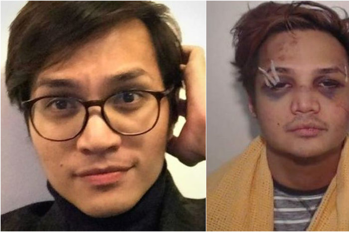 Reynhard Sinaga