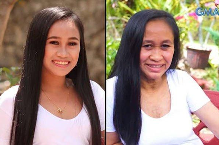 Usia masih 16 tahun, wajah Raizel sudah keriput, tua, dan seperti nenek-nenek 