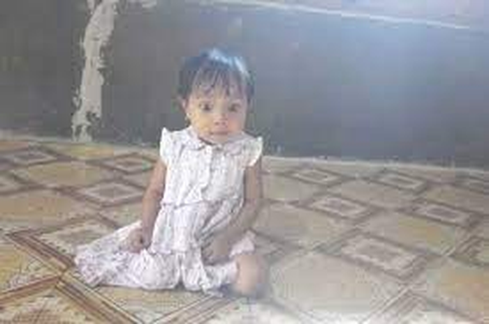 Atqia Nabila, bocah cilik yang mengalami jantung bocor.
