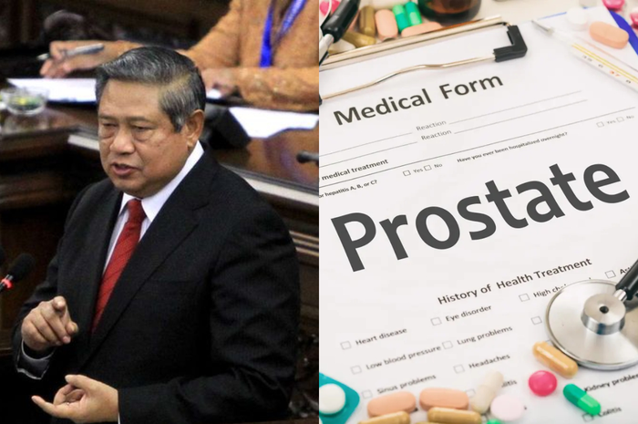SBY didiagnosis mengalami kanker prostat stadium awal.