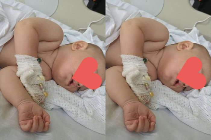 Dikira tumbuh gigi biasa, ternyata bayi ini derita infeksi mengerikan