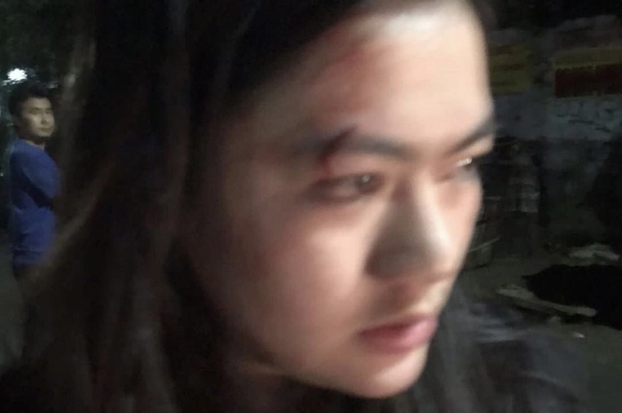 Foto tampang penumpang wanita yang dilecehkan driver Grab Car Godelfridus Janter sudah terlanjur viral di media sosial.