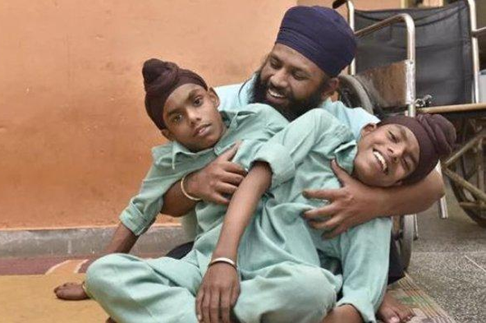 Saudara kembar siam dari India Sohna Singh dan Mohna Singh