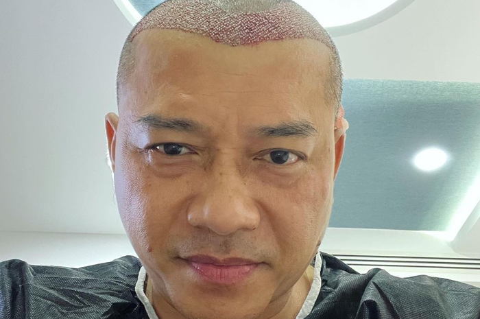 Anang Hermansyah mengunggah foto kepala plontos di media sosial. Kevin Aprillio beri pesan begini.