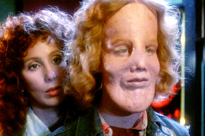 Kisah Hidup Luar Biasa Rocky Dennis, Ketidaknormalan Hidupnya Tak Hentikan  Jalani Kehidupan yang Memuaskan, Bahkan Hidupnya Jadi Inspirasi Film Layar  Lebar 'Mask' | Intisari
