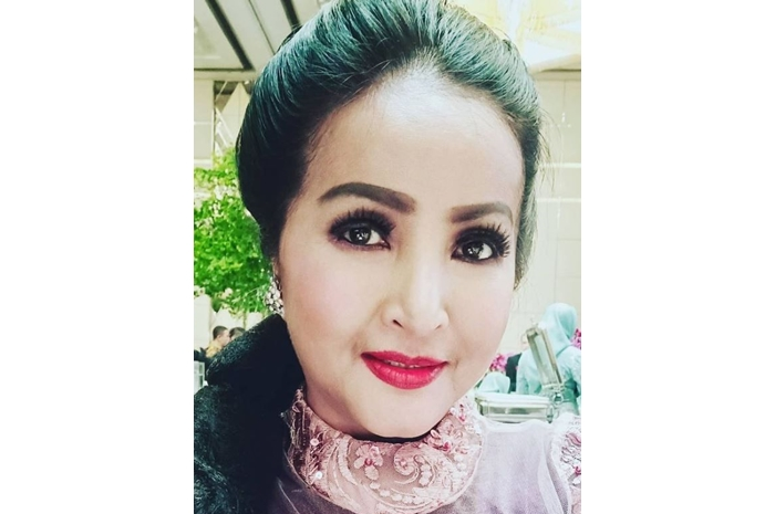 Machica Mochtar jadi korban kecelakaan