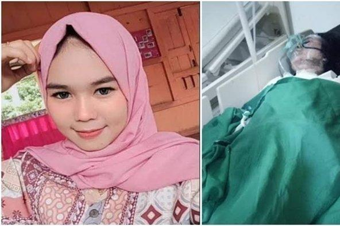Diana Ningsih dibakar hidup-hidup oleh sang kekasih lantaran tak terima diputus.