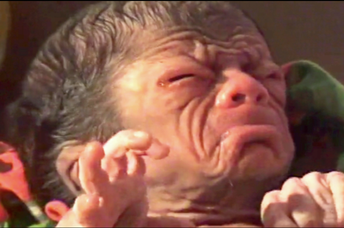 Bayi yang baru lahir memiliki kelainan. Wajahnya seperti kakek usia 80 tahun. Bayi ini juga disebut bawa pesan dari nabi. Begini fakta sebenarnya. 
