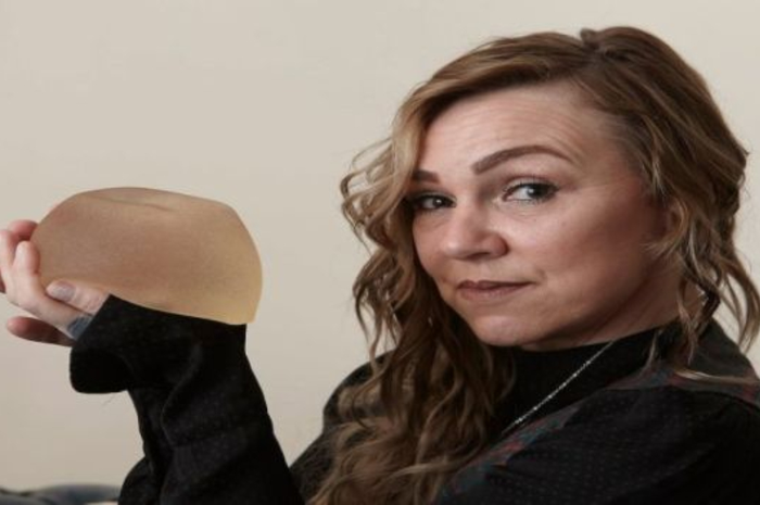 Tonia Rossington, wanita yang melakukan operasi pada dirinya sendiri