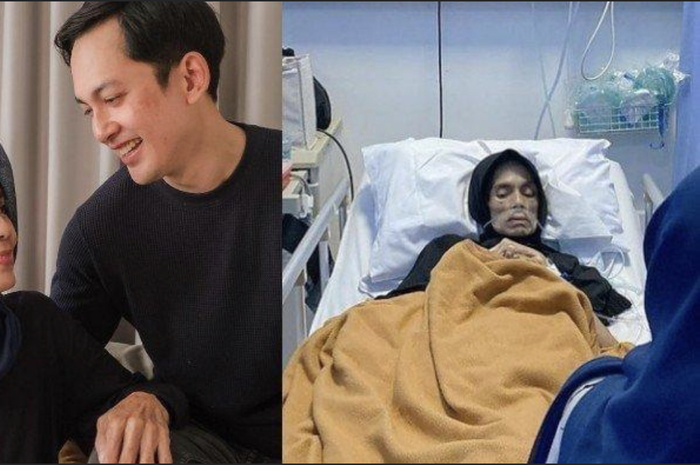 Kiki Farrel pemain sinetron Tukang Bubur Naik Haji bicara kematian di depan mata. Dia pasrah melihat kondisi ibunya yang tinggal tulang. 