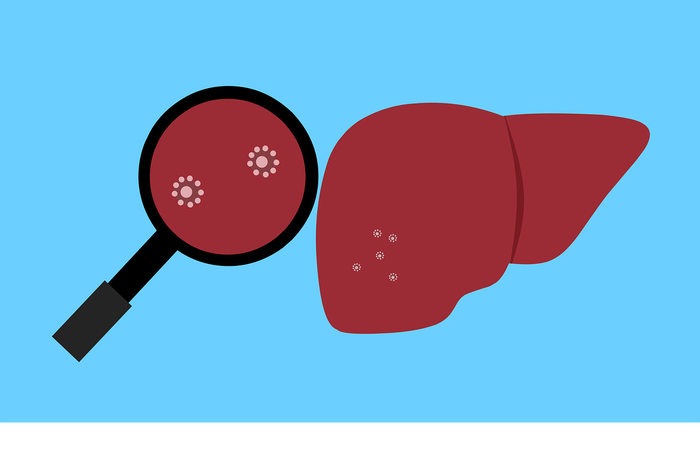 Peneliti Jepang temukan dugaan korelasi antara varian omicron dengan hepatitis akut.