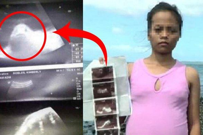 Janin menyerupai ikan di tubuh Kimberley
