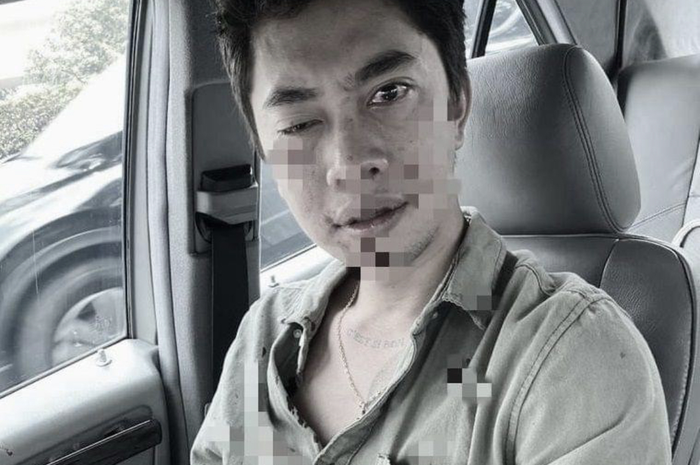 Pengemudi pelat RFH menghajar Justin Frederik anak anggota DPR Indah Kurniawati. Foto wajah korban yang babak belur disebarkan. 