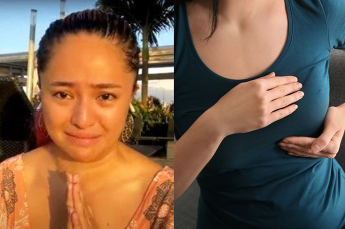Marshanda divonis tumor payudara